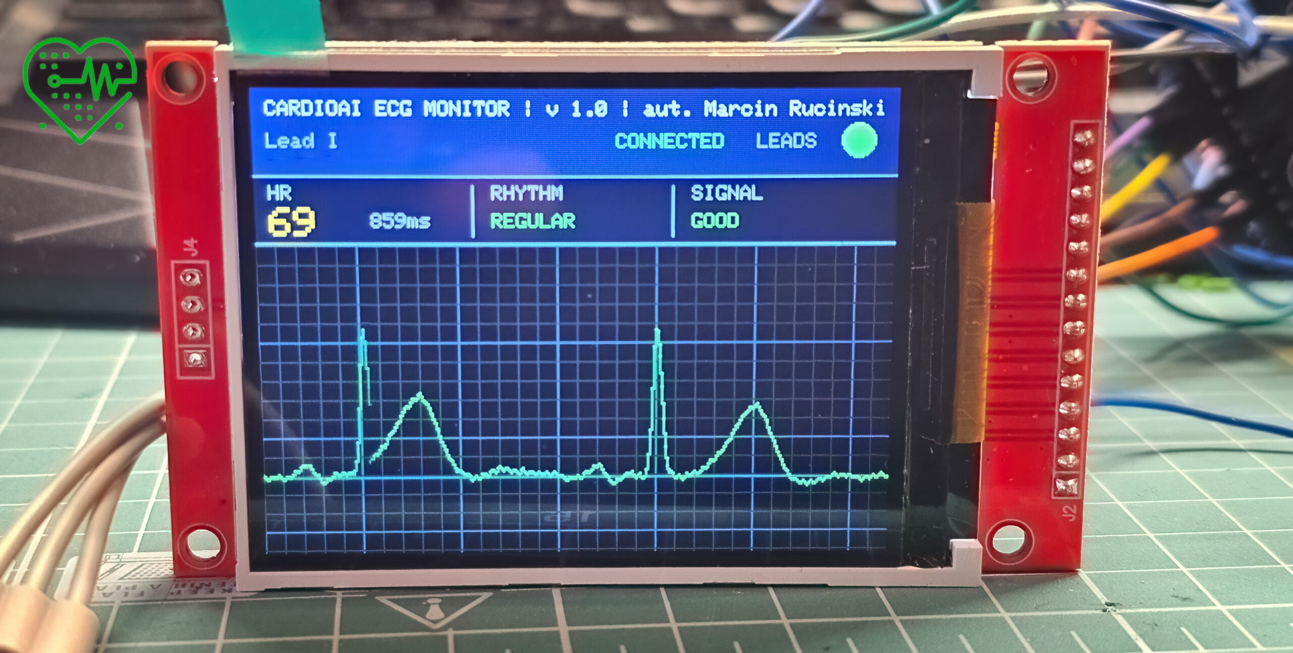 mobilne ekg