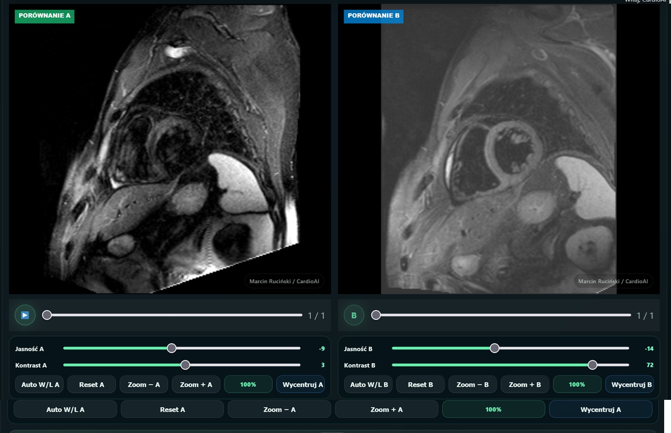 CardioAI — obrazowanie serca i przeglądarka badań CMR/DICOM